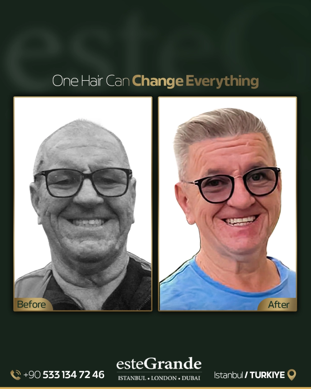 esteGrande Before After 1