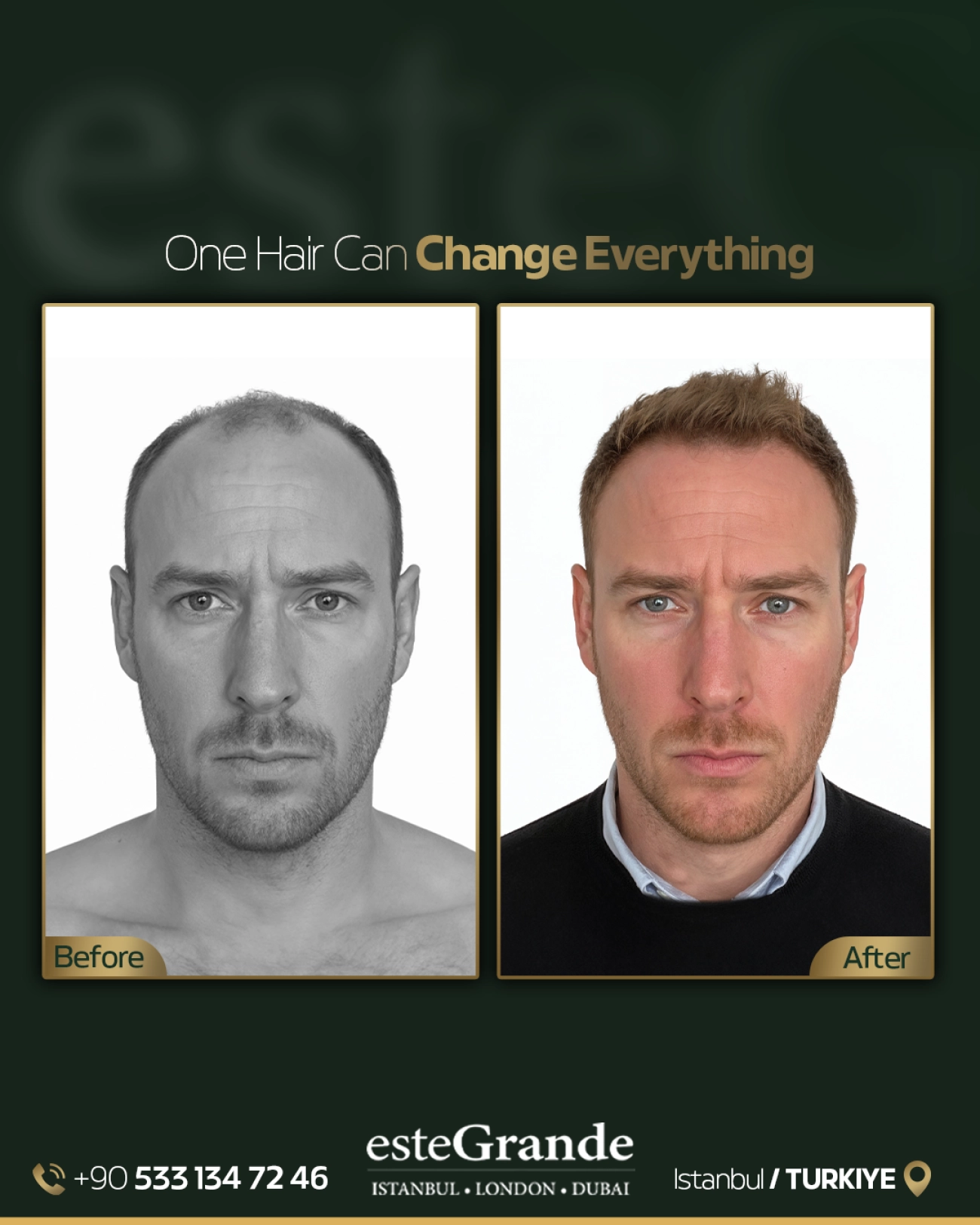 esteGrande Before After 9