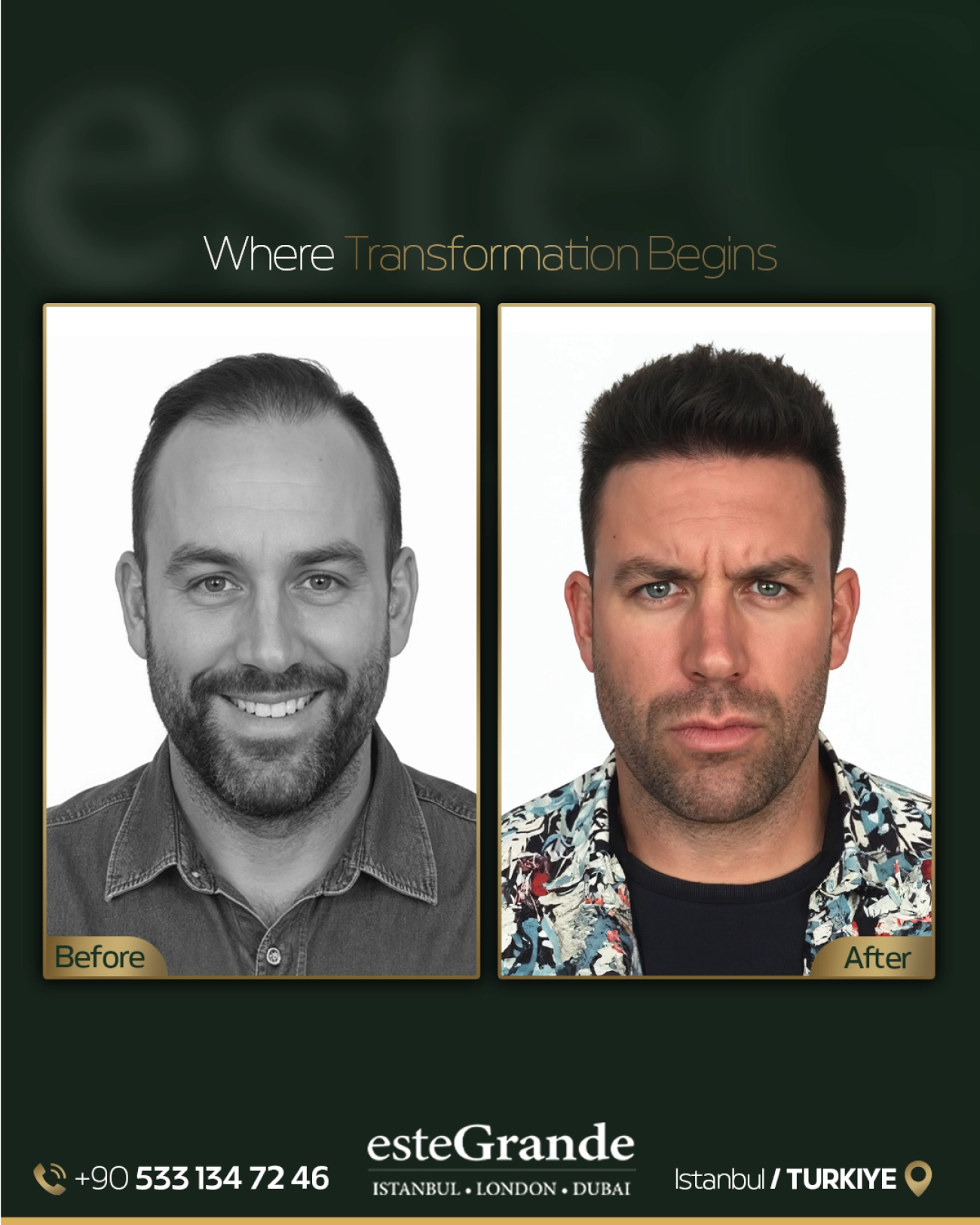 esteGrande Before After 10