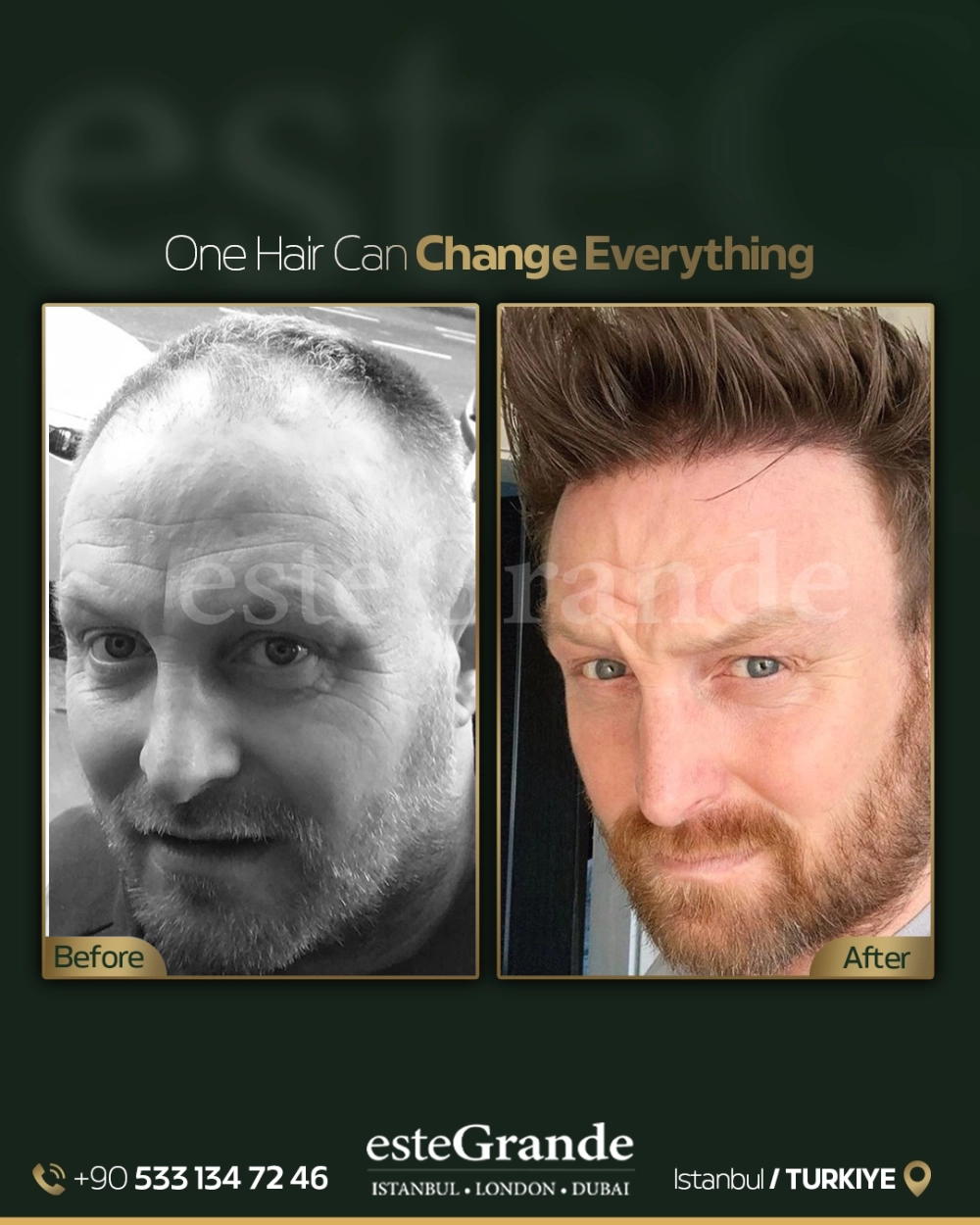 esteGrande Before After 2