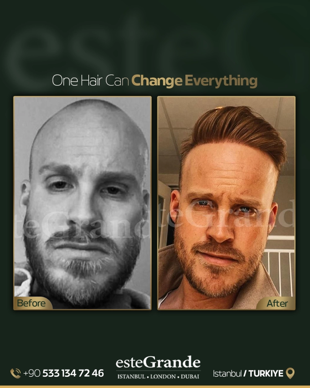 esteGrande Before After 3