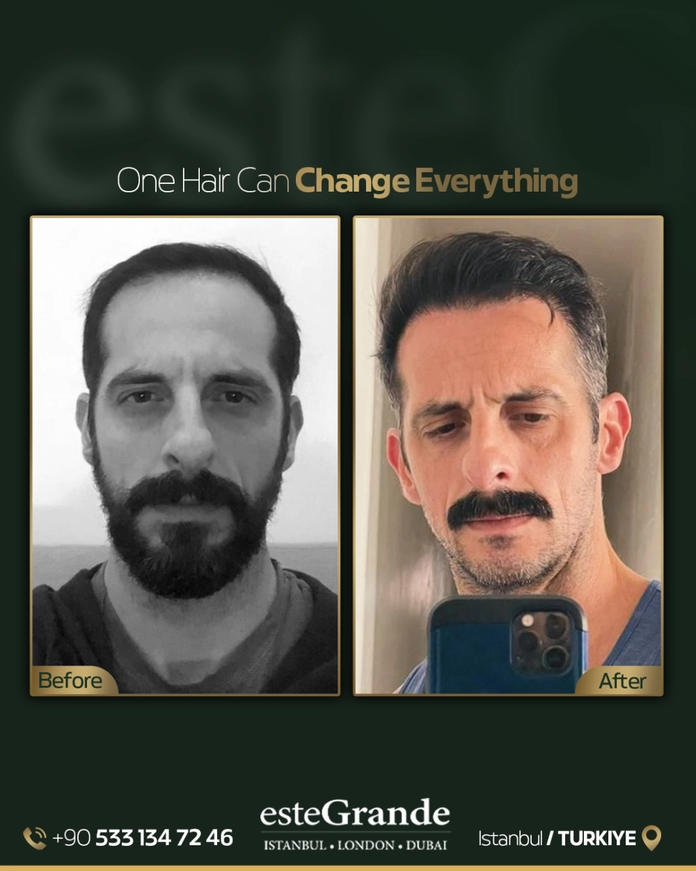 esteGrande Before After 4
