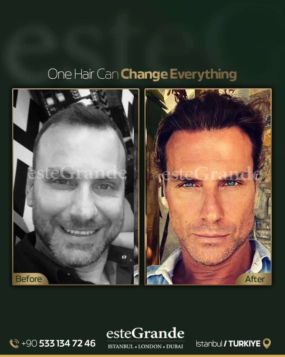 esteGrande Before After 5