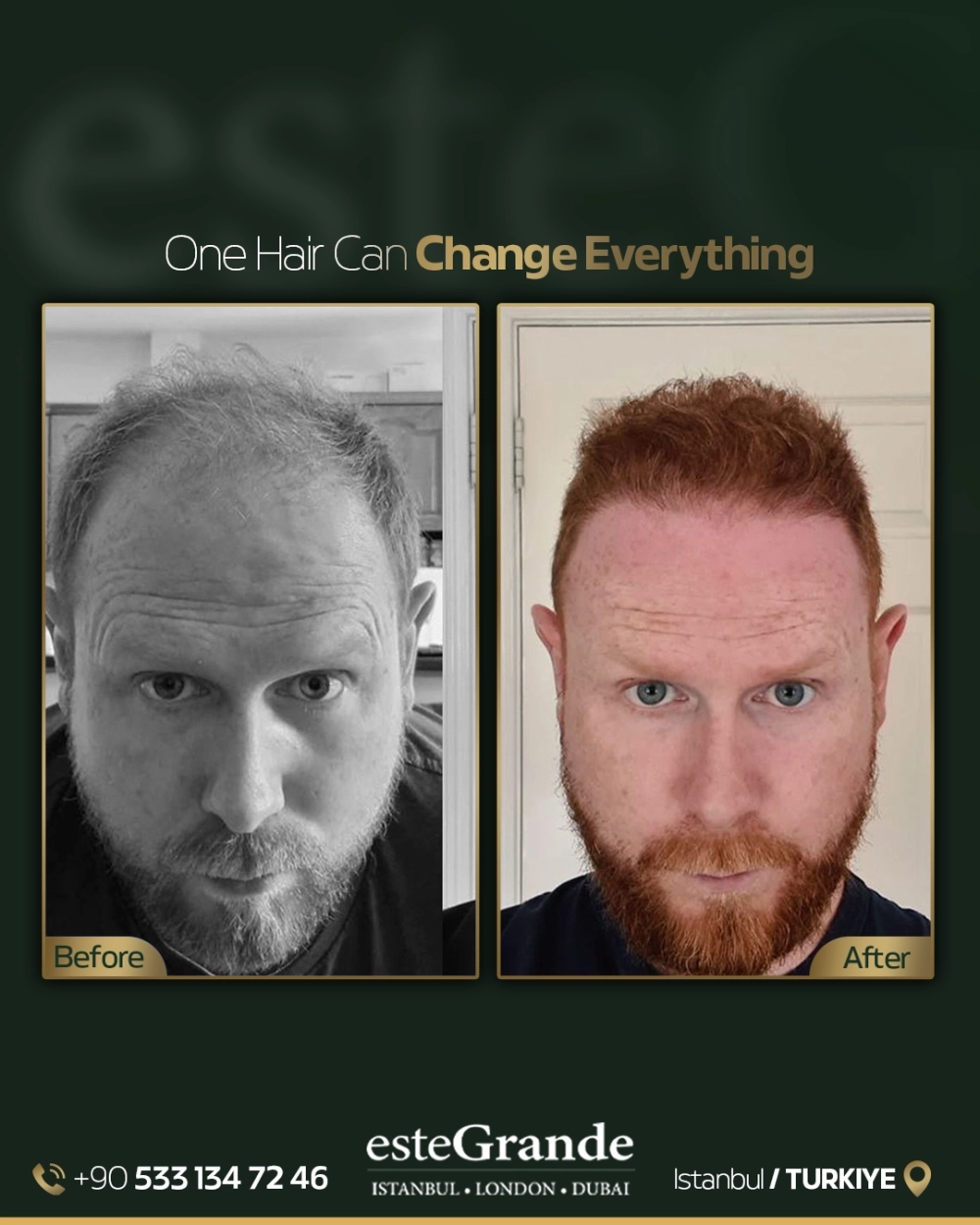 esteGrande Before After 6