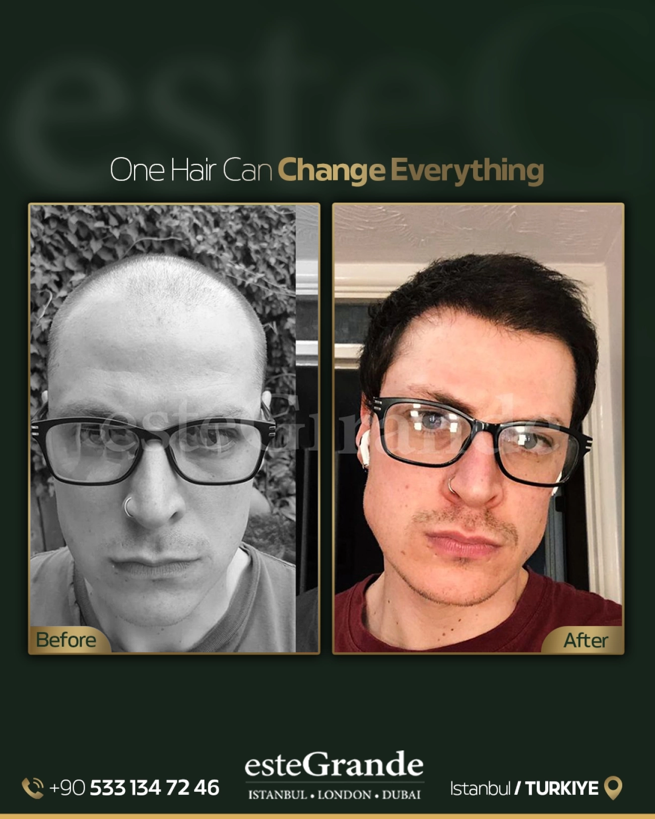 esteGrande Before After 7