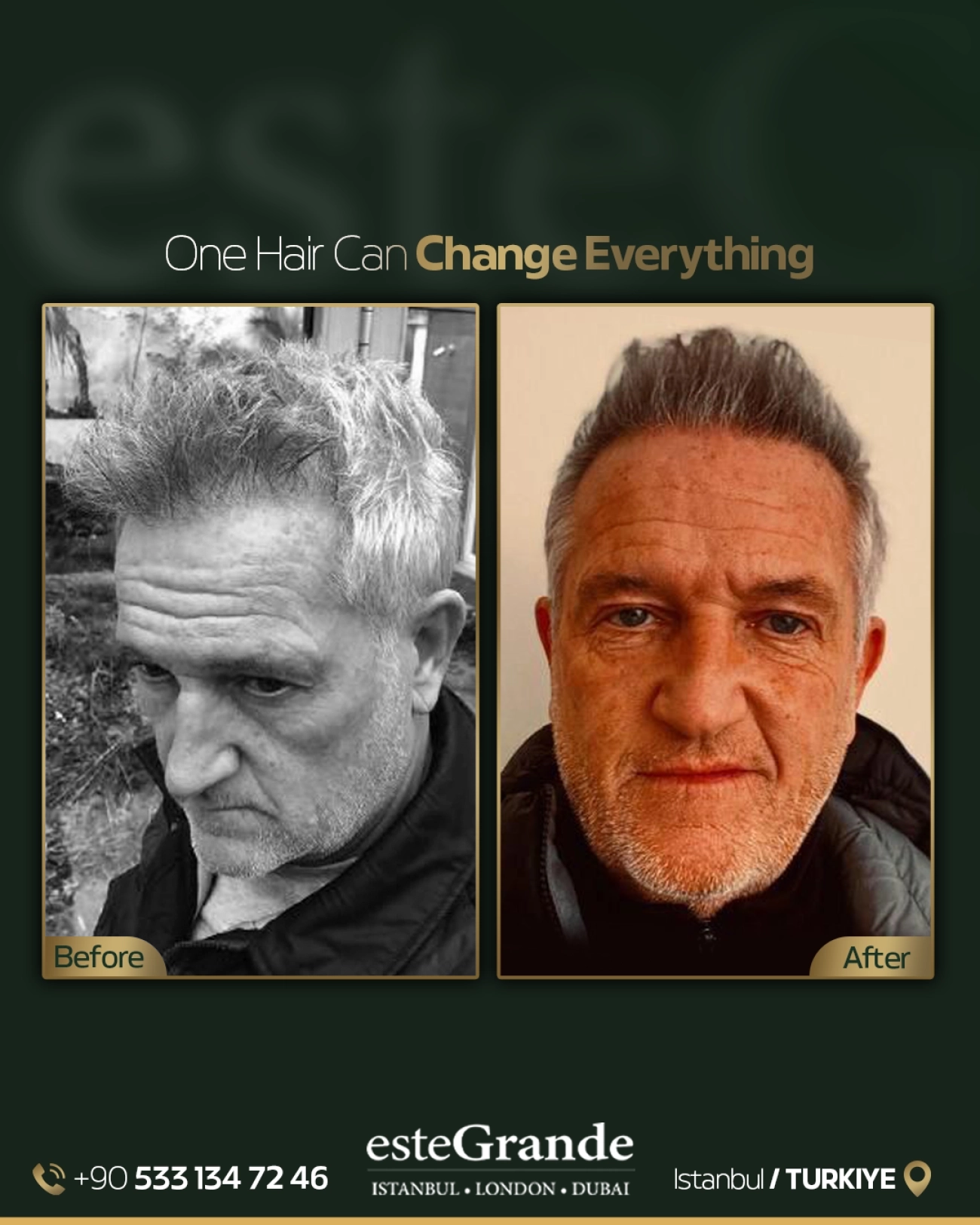 esteGrande Before After 8
