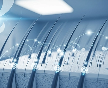 Stem-Cell Hair Transplant