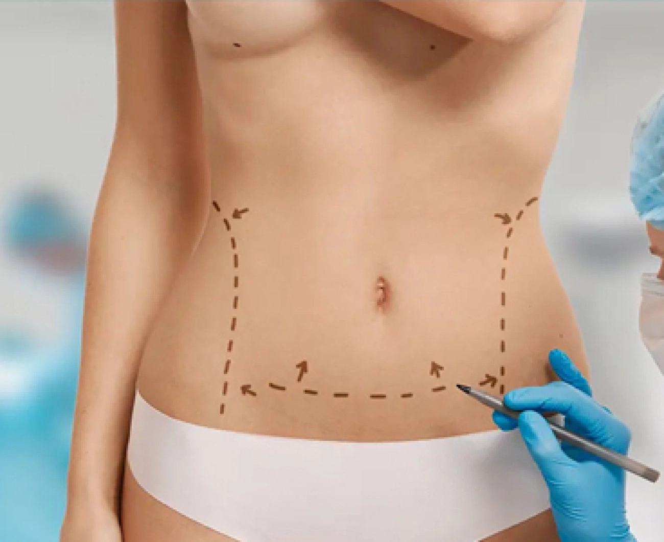 Plastic Surgeries