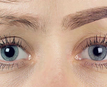 Eyebrow Transplant